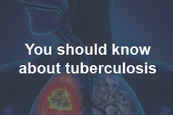 You should know about tuberculosis